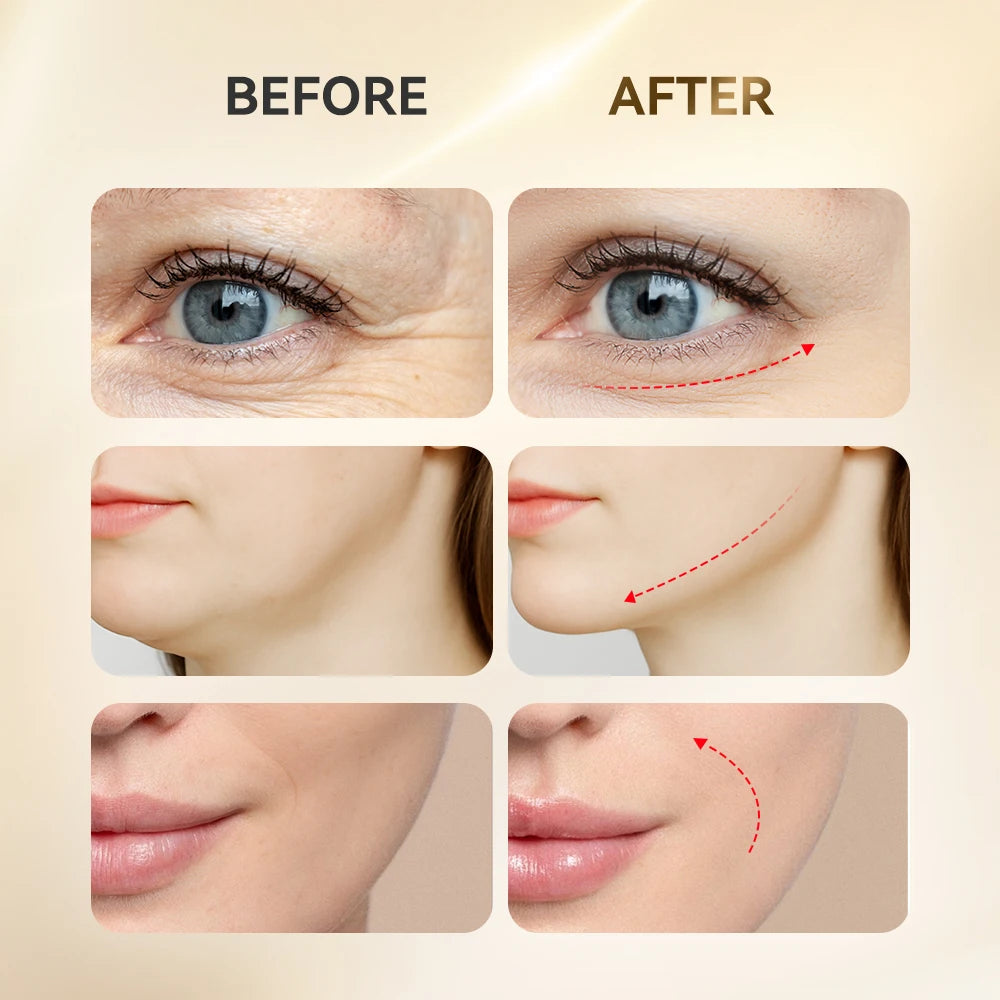 ANLAN LED Eye & Face Massager – Lifting & Light Therapy Device