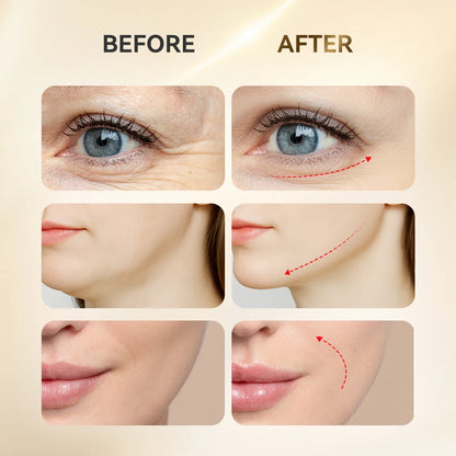 ANLAN LED Eye & Face Massager – Lifting & Light Therapy Device